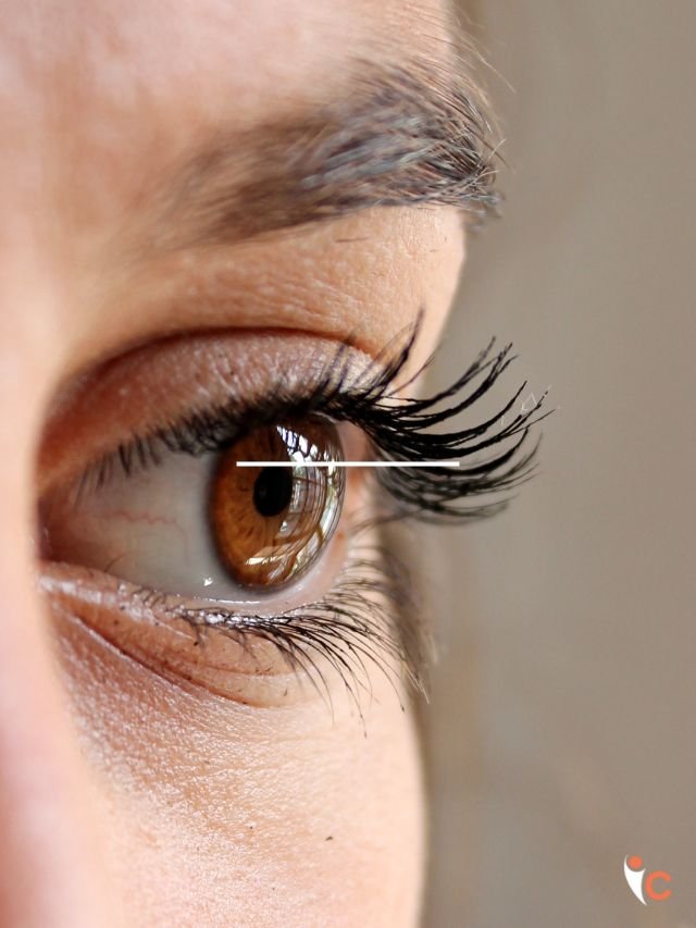 Eye
