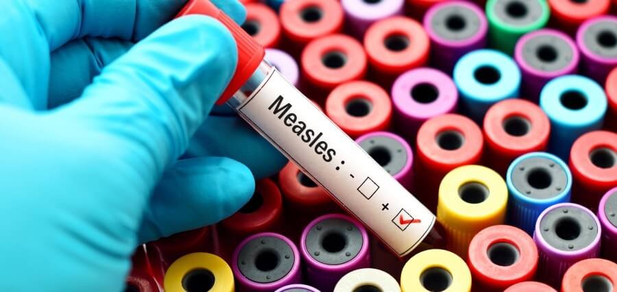 Measles Outbreak in Texas Grows to 124 Cases Amid Vaccination Concerns